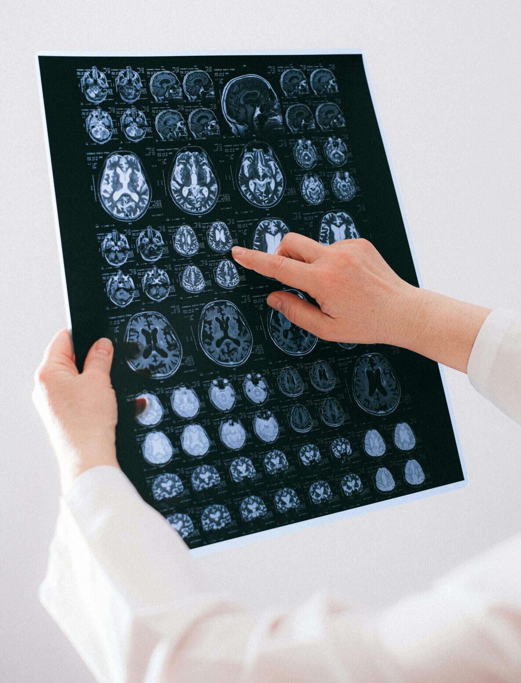 A female doctor holding a brain scan